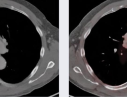 psma pet scan near me Discover Local Solutions